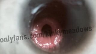 Hollow plug training close up