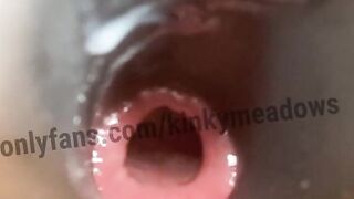 Hollow plug training close up