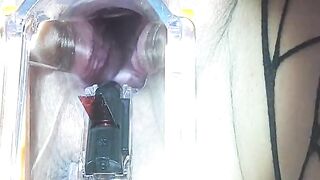 Watch her PUSSY PULSE through a SPECULUM while she CUMS