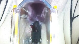 Watch her PUSSY PULSE through a SPECULUM while she CUMS