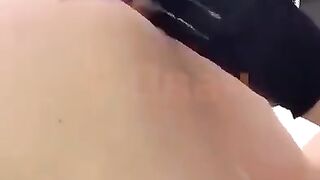 removing tatto from ass